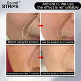 MAGIC STRIPS FOR WRINKLES