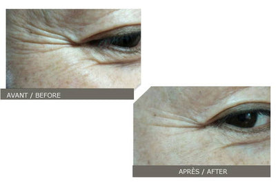 Secret Strip Anti-Wrinkle